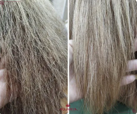 Corte terapêutico