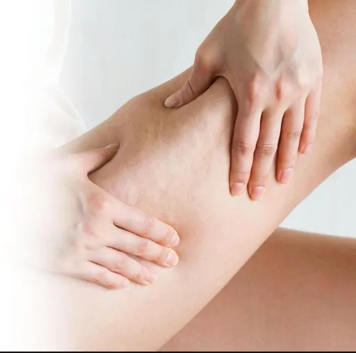 Tratamento para celulite