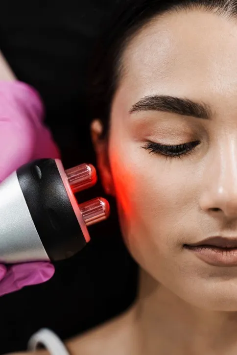 Radiofrequência facial